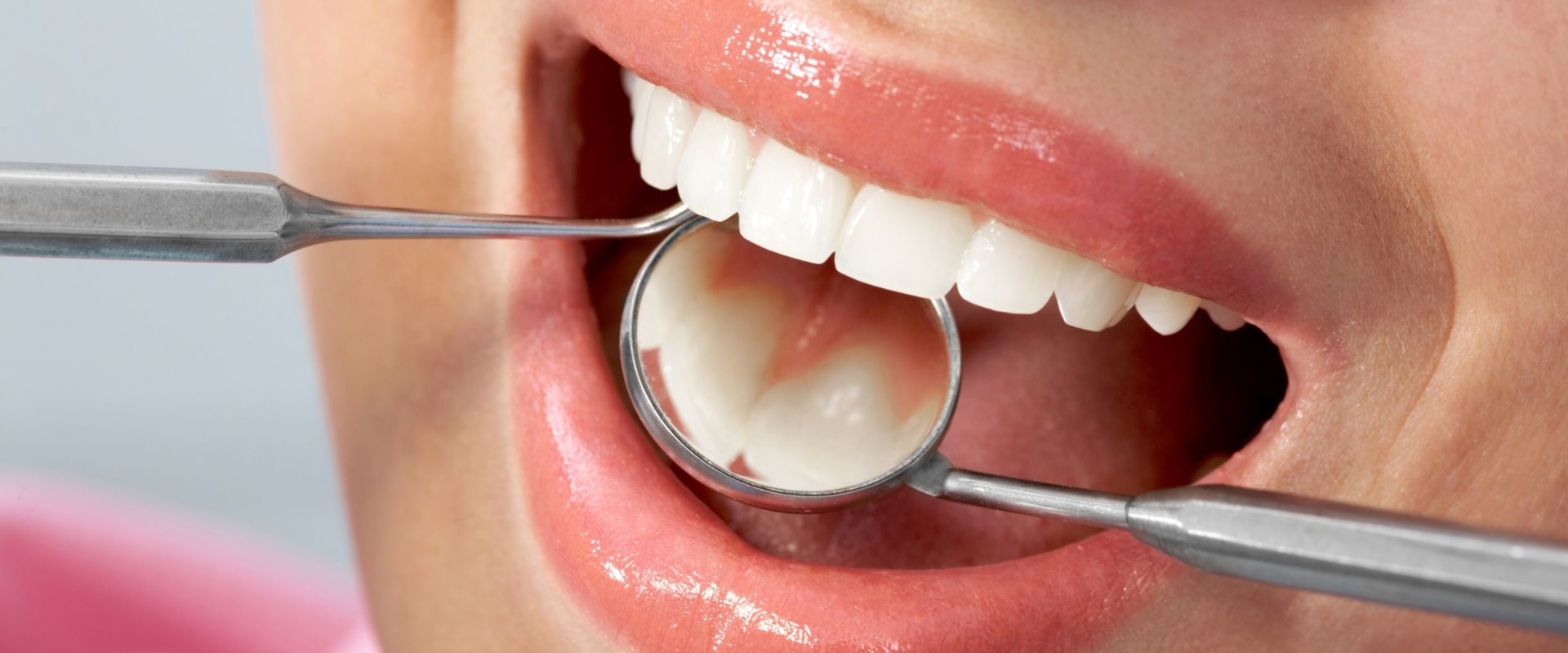 Understanding the Process of Getting a Dental Filling