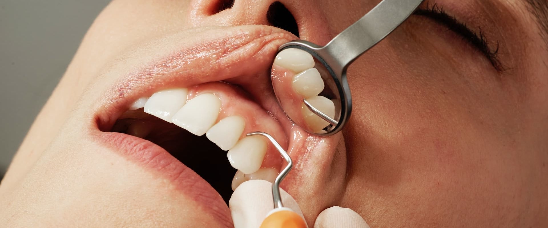 How to Care for Your Orthodontic Appliances: A Comprehensive Guide