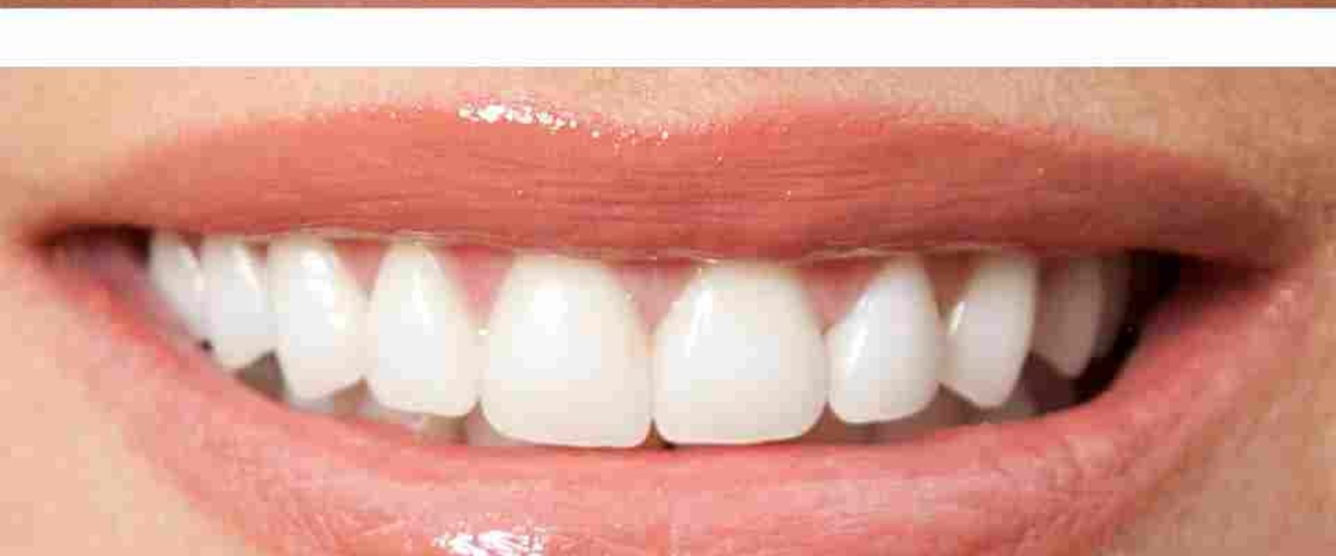 Understanding the Pros and Cons of PPOs for Affordable Dental Coverage