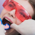 The Importance of Fluoride Treatments for Affordable Oral Health Coverage