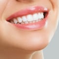 Different Methods for Whitening Teeth: A Comprehensive Guide